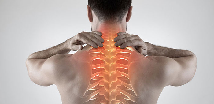 Man with upper back pain before chiropractic treatment from Buckeye chiropractor