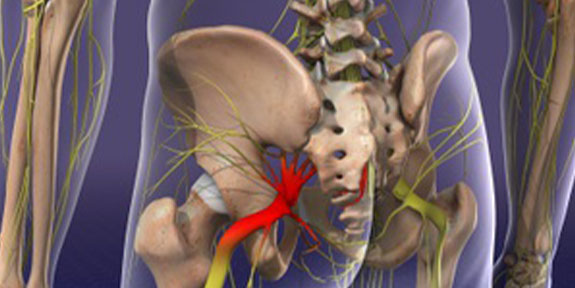 Sciatica Care Buckeye