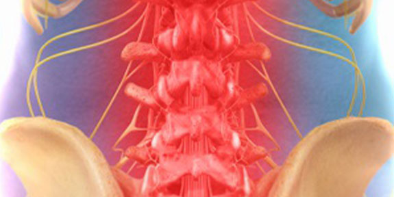 Spinal Decompression Goodyear