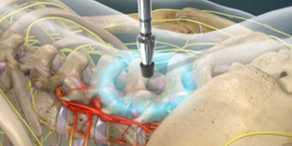 Activator Method Technique Maryvale